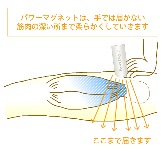 パワーマグネット®では手では届かない筋肉の深い所まで柔らかくしていきます。